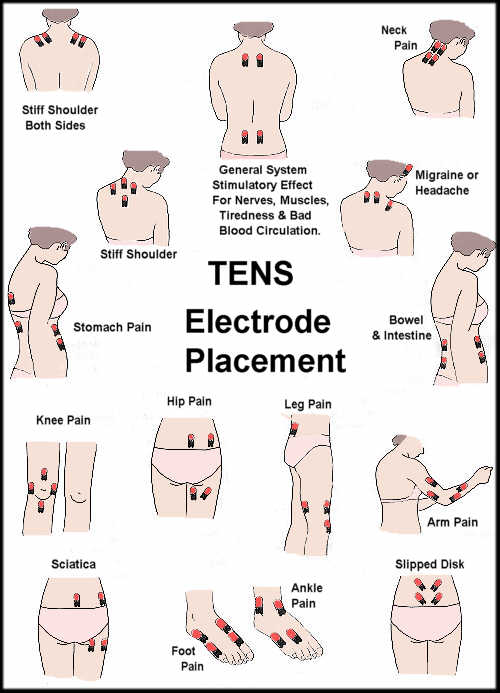 a) TENS with 4 surface electrode system for chronic neck pain